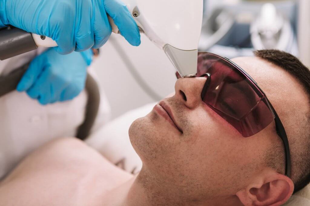 laser hair removal nose hair