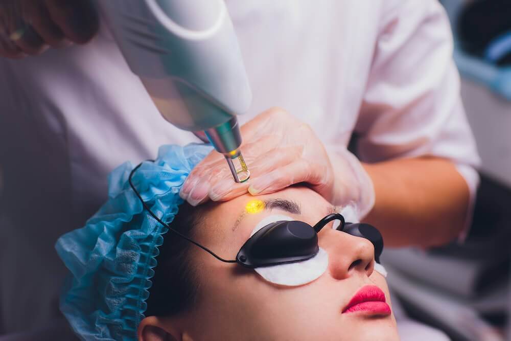 Laser Eyebrow Tattoo Removal [Our Expert Guide] LaserAll