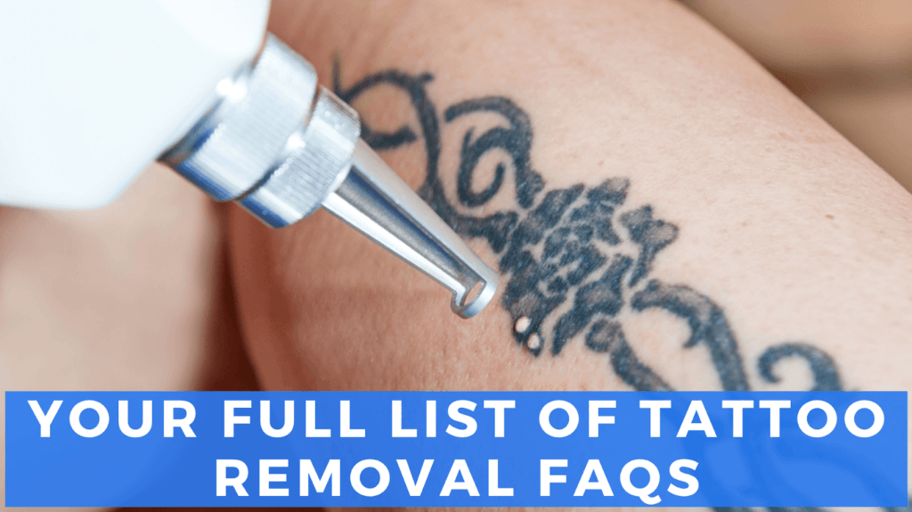 Best Laser Tattoo Removal in Islamabad Pakistan -RCS