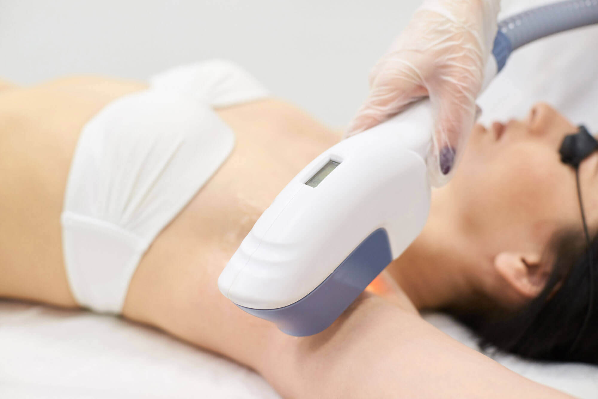 Laser Hair Removal Services Serving Colorado LaserAll